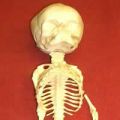 Skeletons