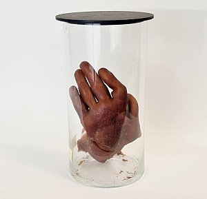 Deformed Hand In Glass Jar