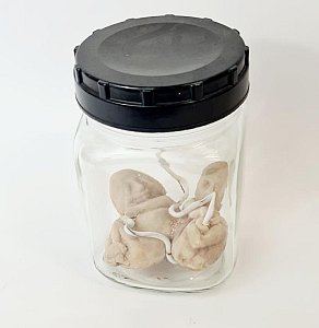 Foetus Models In Glass Jar