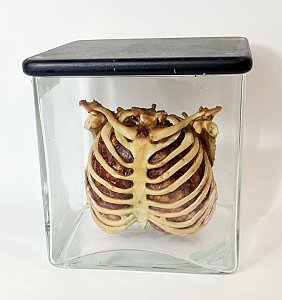 Child Ribcage & Chest In Glass Jar