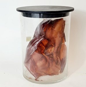 Deformed Face In Glass Jar