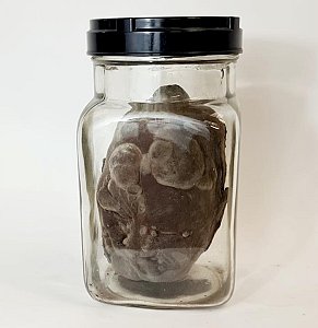 Deformed Head In Glass Jar