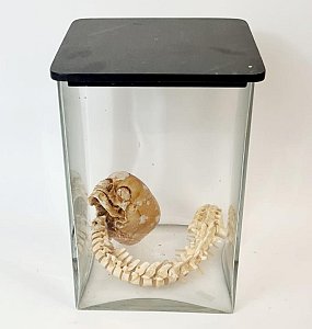 Child Skull &Spine Section In Glass Jar