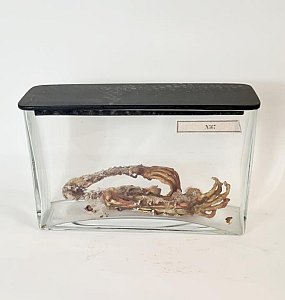 Child Skeletal Arms In Glass Jar