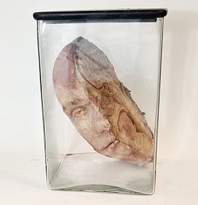 Half Head In Glass Jar