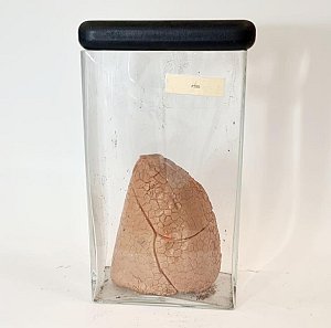 Model Lung In Glass Jar