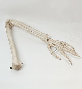 Composite Skeleton Arm