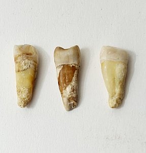 Incisor Human Teeth