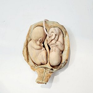 Model Twin Foetus