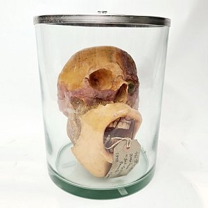 Deconstructed Human Head In Jar