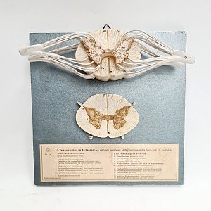 Mounted Spine Section Model Showing Nerves