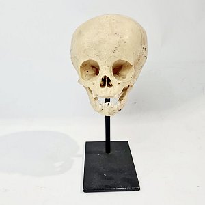 Baby Skull Model On Stand