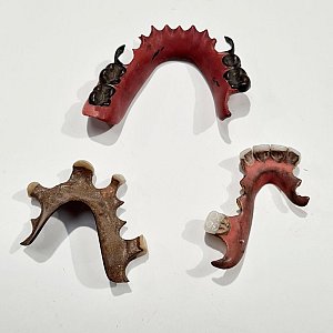 Period Dentures / Dental Bridge