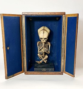 Child Skeleton In Cabinet