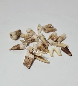 Human Teeth