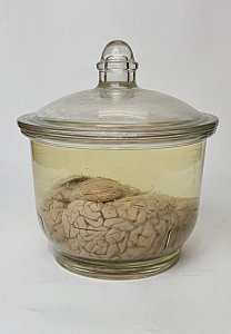 Brain in Jar
