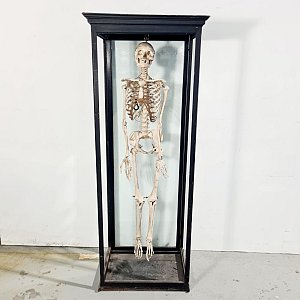 Vintage Human Teaching Skeleton in Glass Case
