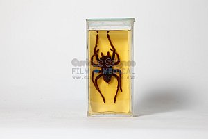Spider in glass jar