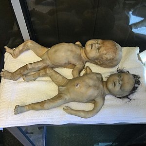 Deformed babies