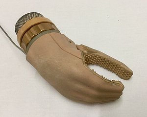 Childâ€™s prosthetic hand
