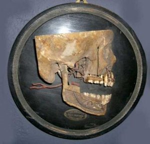Human skull on plaque 19th c
