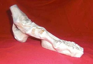 Plaster Foot