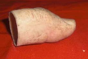 Prosthetic Thumb
