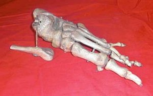 Skeletal Foot