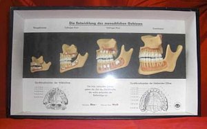 Wax Model Teeth in Glazed Case