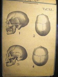 Anatomy chart c1880.