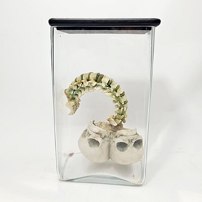 Conjoined Baby Head & Spine In Jar