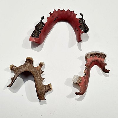 Period Dentures / Dental Bridge