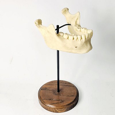 Lower Jaw Model On Stand