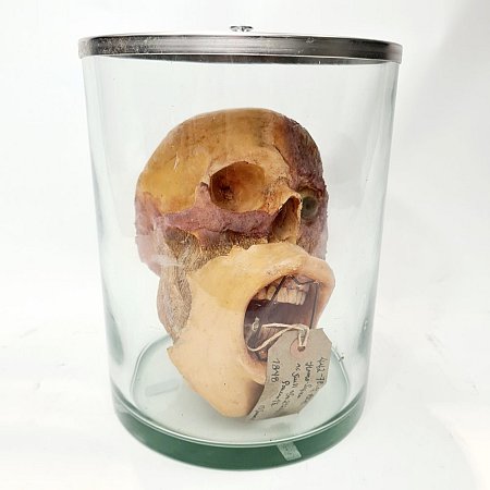 Deconstructed Human Head In Jar