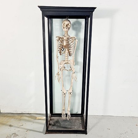 Vintage Human Teaching Skeleton in Glass Case
