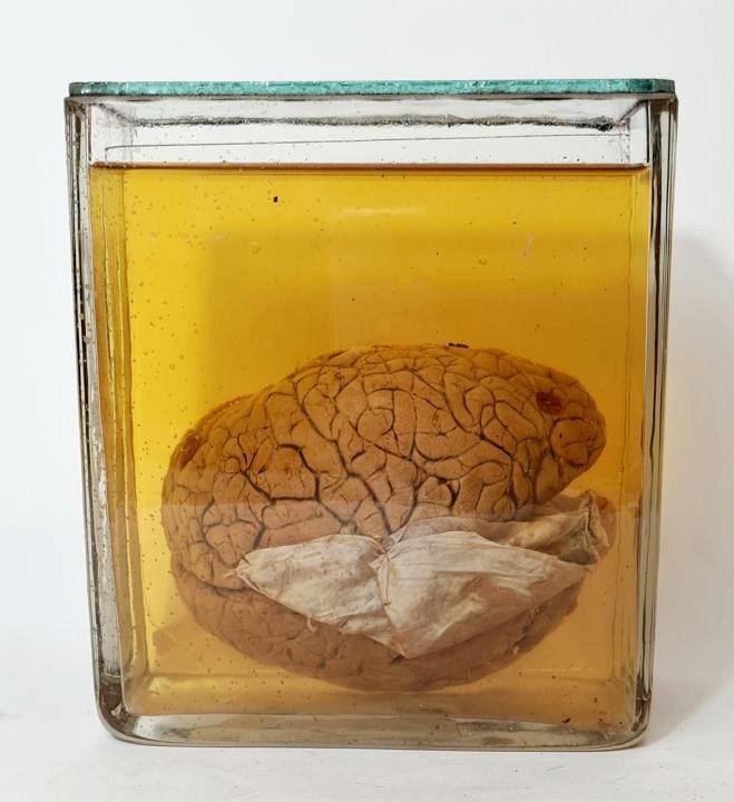Section Of Brain In Preservative