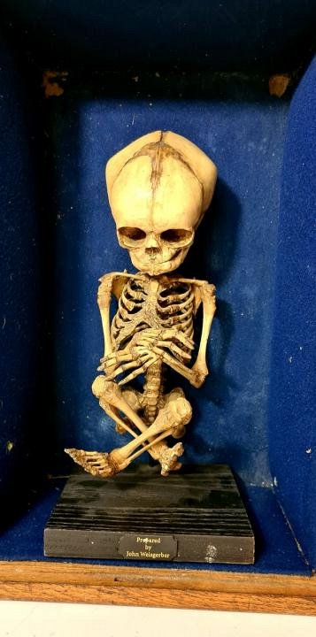 Child Skeleton In Cabinet