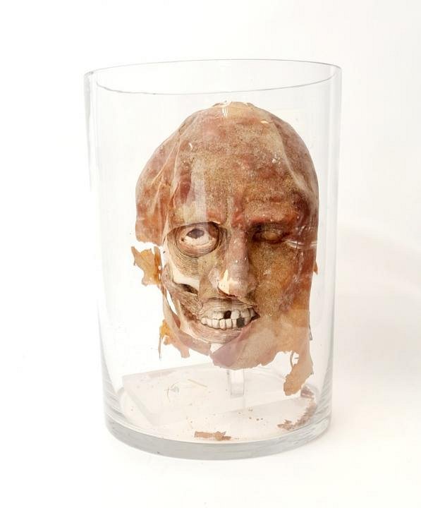 Deformed Head In Glass Jar