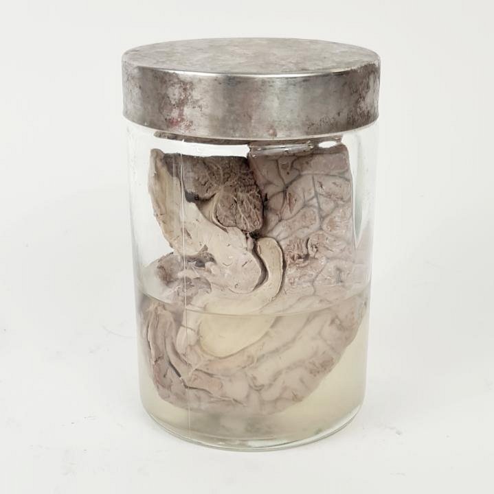 Preserved Brain In Jar