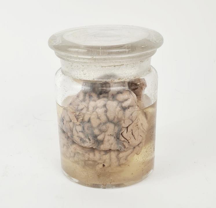 Preserved Brain In Jar