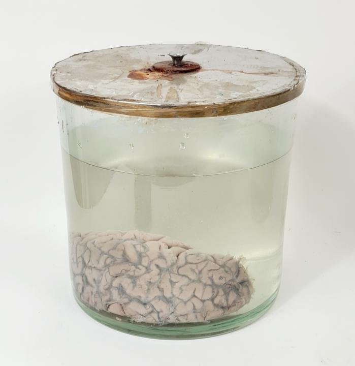 Preserved Brain In Jar