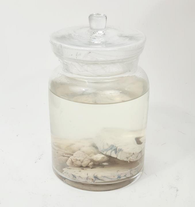 Preserved Brain Slices In Jar