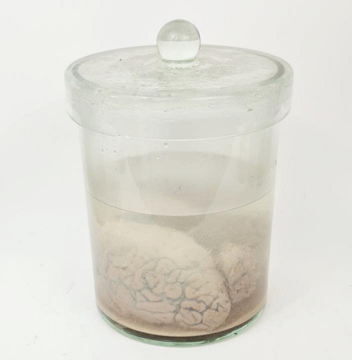 Preserved Brain In Jar