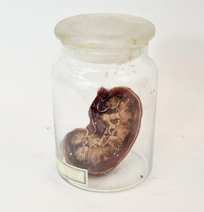 Model Dissected Kidney In Glass Jar