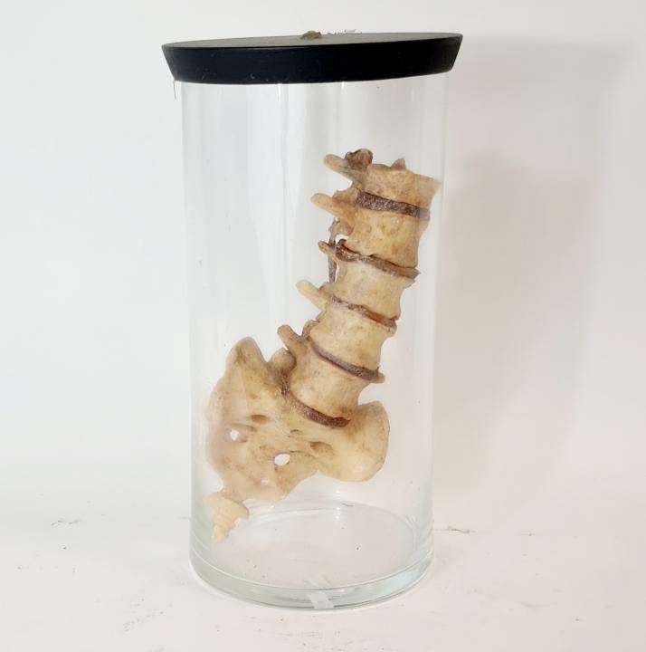 Portion Of Spine In Glass Jar