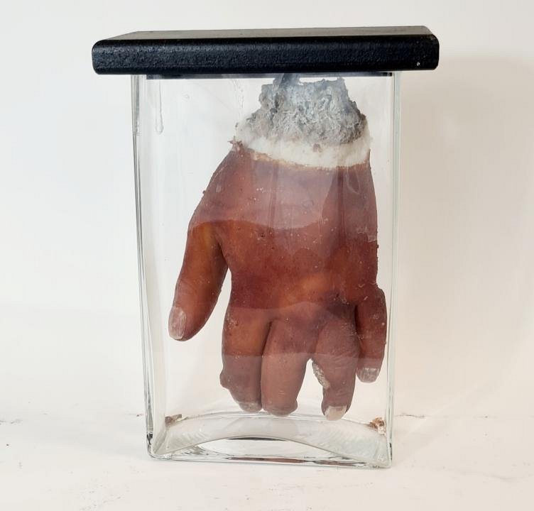 Deformed Hand In Glass Jar