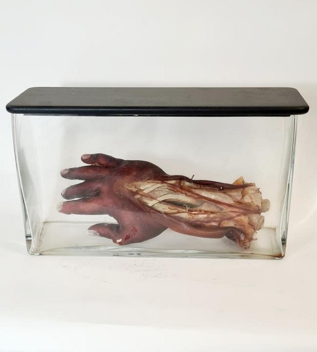 Flayed Hand In Glass Jar