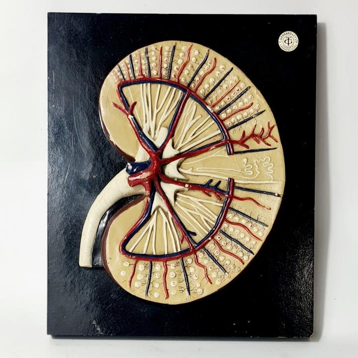 Cross Section Model Kidney