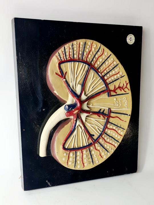 Cross Section Model Kidney