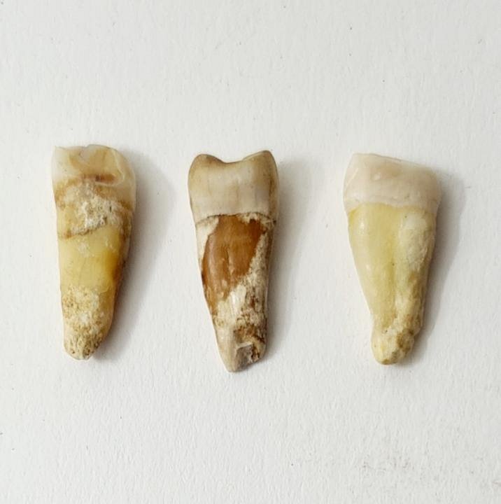 Incisor Human Teeth